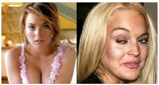 LE AMI ANCORA? ECCO COME DI SONO RIDOTTE MALISSIMO QUESTE CELEBRITA' - 14/12/2016