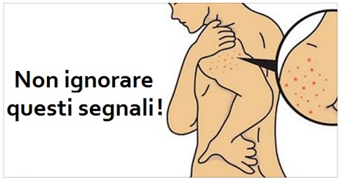 ECCO I 5 SINTOMI CHE GLI INTOLLERANTI AL GLUTINE SPESSO IGNORANO: E' IL CASO CHE TU SIA INFORMATO - 05/04/2017