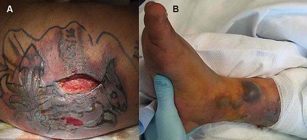 ''NON FARE IL BAGNO DOPO IL TATUAGGIO, POTRESTIMORIRE''. LUI VEDE UN MARE BELLISSIMO E... - 01/06/2017