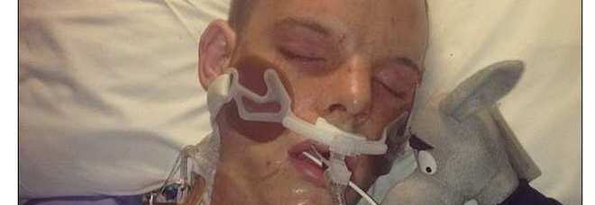 MUORE A 20 ANNI PER LE 'NUOVE DROGHE'. LA MADRE PUBBLICA LA FOTO CHOC IN OSPEDALE - 21/10/2013