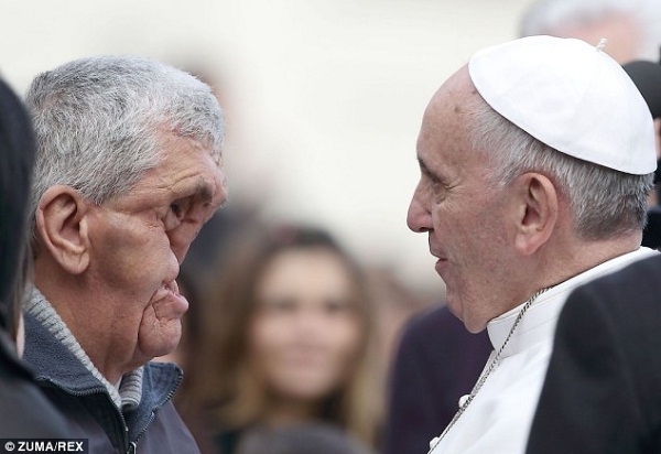PAPA FRANCESCO ABBRACCIA E BACIA L'UOMO SENZA VOLTO - FOTO - 21/11/2013