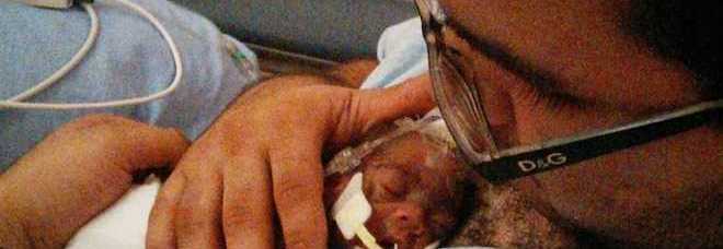 BIMBO NASCE DI 5 MESI E PESA 600 GRAMMI, OGGI STA BENE. IL PADRE: ''È UN COMBATTENTE'' - 10/01/2014