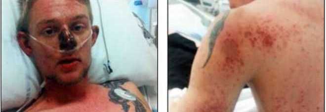 CURA L'INFLUENZA CON UN NORMALE FARMACO DA BANCO E FINISCE IN COMA - 20/01/2014