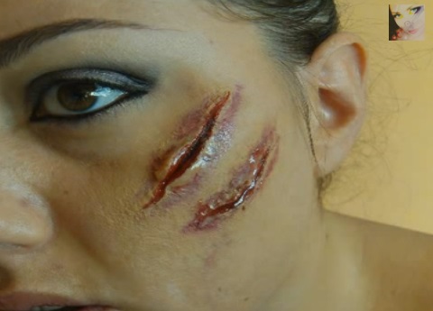 COME CREARE UNA FERITA ARTIFICIALE IN MODO VELOCISSIMO - GUARDA IL VIDEO - 21/02/2014