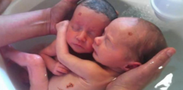 GEMELLI NATI CON I SIMBOLI DELL'APOCALISSE: ECCO LA REAZIONE - FOTO - 19/05/2014