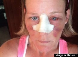 MASSACRATA DAL COMPAGNO: ANGELA DECIDE DI POSTARE SU FB LE FOTO: 'MA QUESTO E' AMORE?' - 03/06/2014