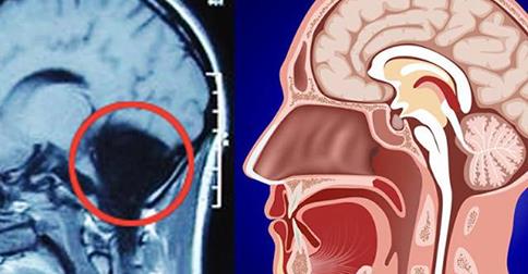 A 24 ANNI SOFFRE DI CONTINUO DI VERTIGINI E NAUSEA, VA DAL MEDICO E FA UNA SCOPERTA INCREDIBILE - 14/09/2014