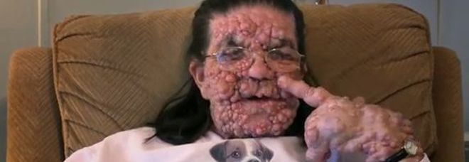 ''NON POSSO VEDERE MIO NIPOTE, LO SPAVENTEREI'', IL DRAMMA DI UNA NONNA MALATA DI TUMORE - 11/11/2014