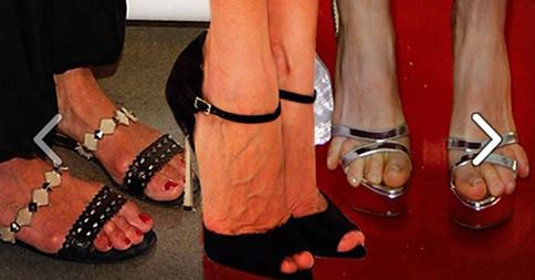 DIFETTI DA STAR: 10 CELEBRITIES CON I PIEDI BRUTTI - 09/10/2014