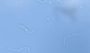COSA SONO QUEI ''VERMETTI VOLANTI'' CHE VEDIAMO MUOVERSI NEGLI OCCHI? - 08/01/2015