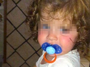 ADDIO ALLA PICCOLA IRENE, NON CE L'HA FATTA LA BIMBA MALATA DI CUORE - 31/10/2015