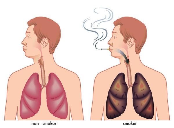 VUOI DEPURARE I TUOI POLMONI DAL FUMO? ECCO COME FARE CON QUESTO METODO NATURALE - 14/03/2016