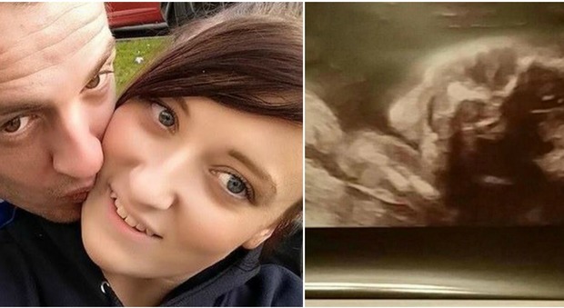 MUORE ENNE INCINTA, LA DRASTICA DECISIONE DEL MARITO: ''COSI' STARANNO INSIEME PER SEMPRE'' - 20/03/2016