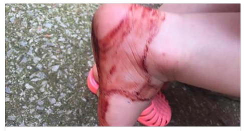 MOSTRA I PIEDINI INSANGUINATI DELLA FIGLIA: QUELLO CHE C'E' DIETRO VI FARA' VENIRE I BRIVIDI - 08/06/2016
