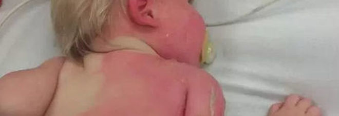 MAMMA BAGNA IL FIGLIO DI 9 MESI CON LA POMPA E LUI INIZIA A PIANGERE: ECCO IL MOTIVO CHOC - 12/06/2016