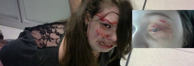 CIECA E MALATA DI TUMORE PESTATA A SANGUE ALL'AEROPORTO: LA FAMIGLIA CHIEDE I DANNI - 06/07/2016