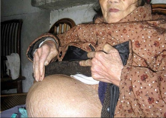 UNA DONNA DI 93 ANNI SCOPRE DI ESSERE RIMASTA INCINTA: ECCO COS'E' SUCCESSO - 08/07/2016