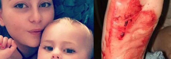 I PIEDINI DELLA FIGLIA SONO COPERTI DI SANGUE, LA DENUNCIA CHOC: ''DISTRUTTI DAI SANDALI'' - 25/09/2016