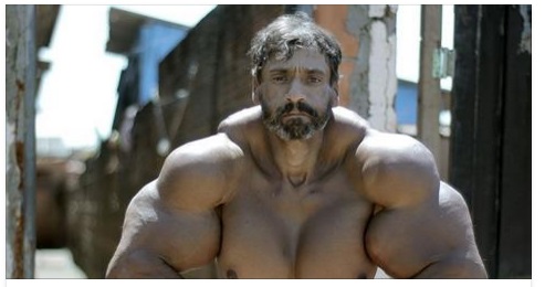 ''VOGLIO ESSERE COME HULK'': MA POTREBBE PERDERE L'USO DI BRACCIA E GAMBE - 09/10/2016