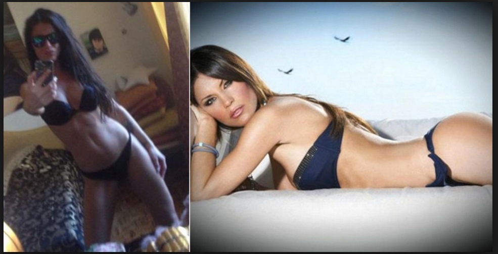 ANTONELLA MOSETTI PRIMA E DOPO GLI INTERVENTI CHIRURGICI - 20/10/2016