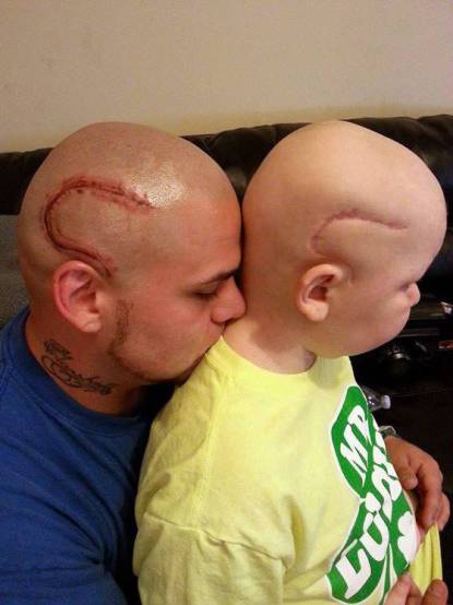 UN PAPA' NON ACCETTA CHE IL FIGLIO MALATO DI CANCRO SI SENTA UN ''MOSTRO'' - 01/11/2016