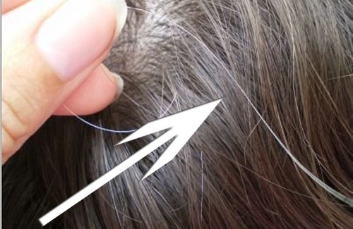 CAPELLI BIANCHI ADDIO: MIRACOLOSO METODO NATURALE - VIDEO - 15/01/2017