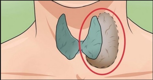 7 SEGNALI DEL CORPO CHE INDICANO UN MALFUNZIONAMENTO DELLA TIROIDE - 21/03/2017