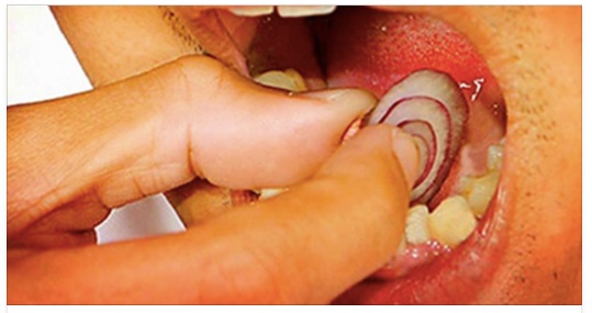 ECCO CHE COSA ACCADE SE METTIAMO LA CIPOLLA SU UN DENTE: RESTERETE STUPITI - 27/12/2016