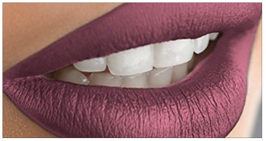 IL ROSSETTO DI NATALE CHE STA FACENDO IMPAZZIRE TUTTE: ECCO PERCHE' - 27/12/2016