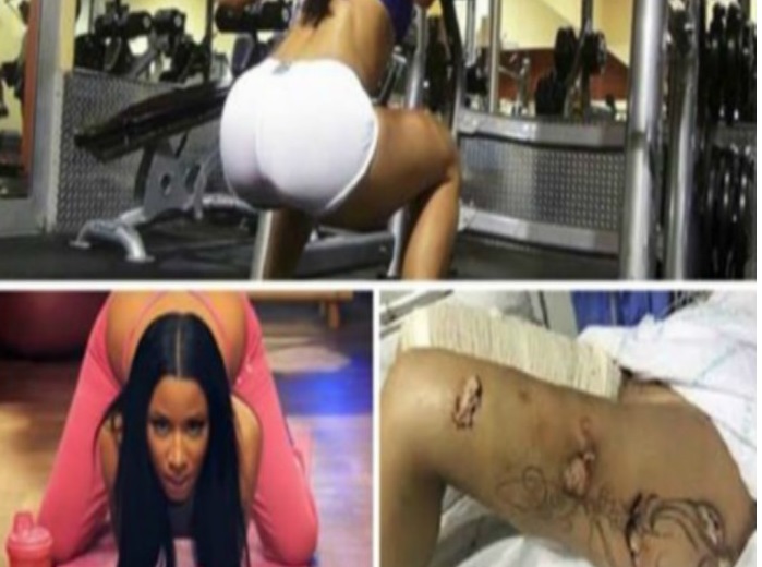 LA TRISTE STORIA DELLA DONNA CHE HA VISTO ''ESPLODERE'' IL SUO SEDERE IN PALESTRA: ECCO COS'E' SUCCESSO - 22/12/2016