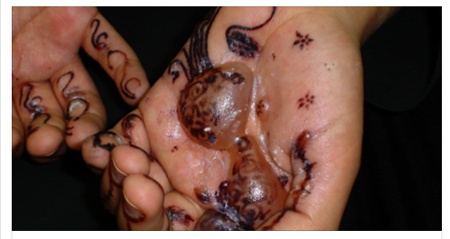 TATUAGGI, L'ALLARME: ''E' PERICOLOSO E CANCEROGENO'' - 10/07/2016