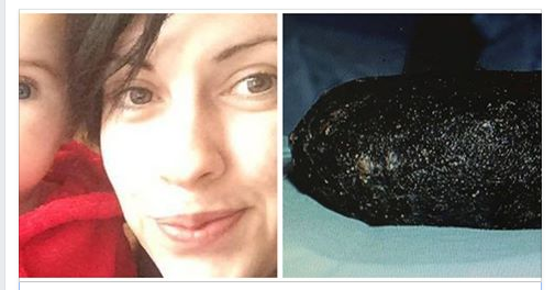 VA IN OSPEDALE PER IL MAL DI STOMACO, I MEDICI FANNO UNA SCOPERTA CHOC - 10/07/2016