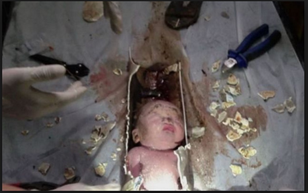 NEONATO GETTATO NELLO SCARICO DI UN WC CON UN SACCHETTO DI PLASTICA IN TESTA: I SOCCORRITORI SCOPPIANO IN LACRIME - 05/10/2016