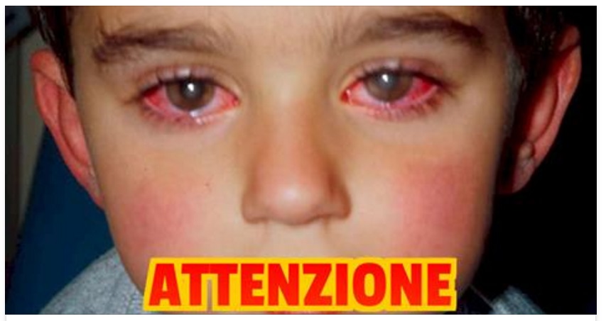 ATTENZIONE: PERDE LA VISTA PER COLPA DI UN ''GIOCATTOLO'' CHE AVETE TUTTI IN CASA - 11/01/2017