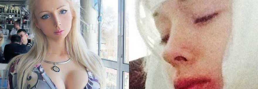 VALERIA, LA BARBIE UMANA COL VOLTO TUMEFATTO: ''HANNO TENTATO DI STRANGOLARMI'' - 06/11/2014