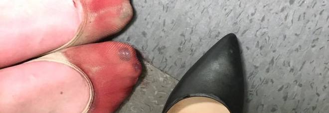 COSTRETTA A LAVORARE CON I TACCHI, LA DOLOROSA FOTO DELLA CAMERIERA A FINE TURNO - GUARDA - 12/05/2016