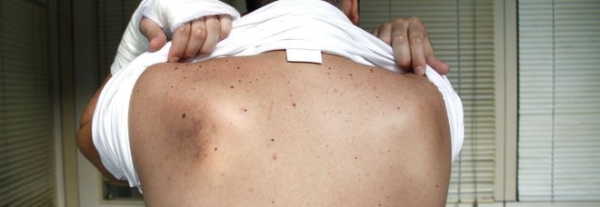 TASSISTA DENUNCIA: ''PRESO A SCHIAFFI E CALCI DAGLI AGENTI'' - FOTO - 27/09/2013