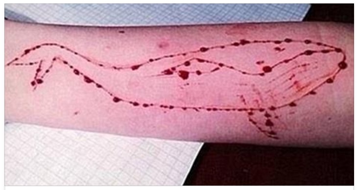 ''GENITORI, SALVATE I VOSTRI FIGLI DA QUESTA STUPIDA SFIDA'' LA POLIZIA AVVERTE - 01/05/2017