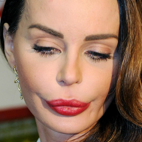 NINA MORIC RIMUOVE ACIDO E BOTULINO DAL VOLTO: ECCO  LA TRASFORMAZIONE DI COM'E' OGGI - 15/12/2016