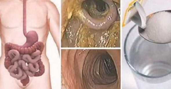 ECCO COME DEPURARE IL COLON E PERDERE FINO A 10 CHILI IN 3 SETTIMANE - 07/09/2016