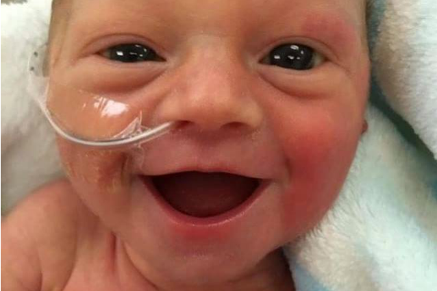 ''ERA FELICE DI ESSERE VIVA'': IL DOLCE SORRISO DELLA BIMBA PREMATURA COMMUOVE IL WEB - 21/10/2016
