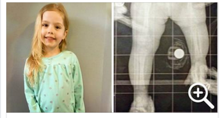 SCEGLIE DI ROMPERE LE GAMBE DELLA FIGLIA DI 4 ANNI: L'INASPETTATO MOTIVO - 29/05/2016