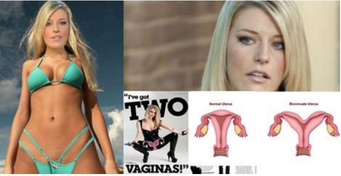 LA STORIA E LE CONFESSIONI DELLA RAGAZZA NATA CON DUE VAGINE - 02/06/2016