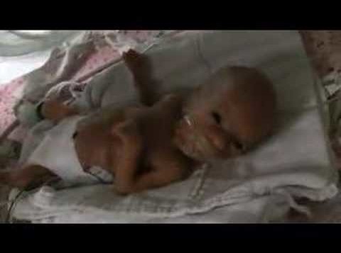 UN VIDEO CHE SCONVOLTO IL WEB: LOTTA CON LA MORTE A SOLO TRE GIORNI DI VITA - 24/10/2013