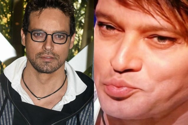 RICORDATE QUANDO GARKO SI MOSTRO' IN TV COL VOLTO GONFISSIMO? SI CELAVA UN DOLORE: HA CONFESSATO LA SUA SOFFERENZA - 31/05/2017