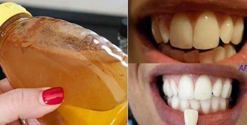 ECCO IL MODO PIU' EFFICACE PER SBIANCARE I DENTI CON UN SOLO INGREDIENTE - 26/10/2016