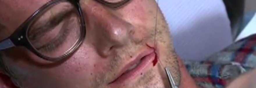 PRESENTATORE SI FA CUCIRE LA BOCCA IN DIRETTA TV: TUTTO CON AGO, FILO E SENZA ANESTESIA - VIDEO - 21/10/2013