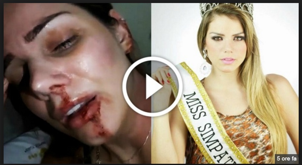 ''CHE FACCIO CON UN MOSTRO DEL GENERE?'': LE IMMAGINI SHOCK DELLA MISS PICCHIATA DALL'EX - 30/11/2016