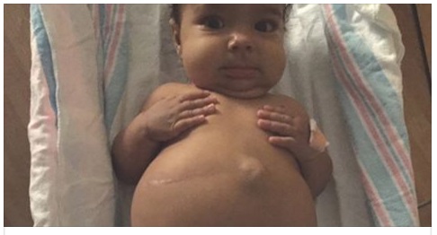 LA SUA PANCIA INIZIA A GONFIARSI: POI LA SCOPERTA SHOCK DEI MEDICI NELLA SUA PANCIA - 25/12/2016