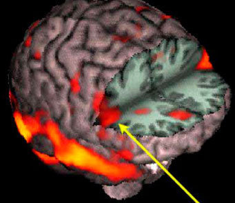 FAMO 1 MINUTO DE SILENZIO PE' TUTTI I NOSTRI NEURONI MORTI !! - 10/03/2012